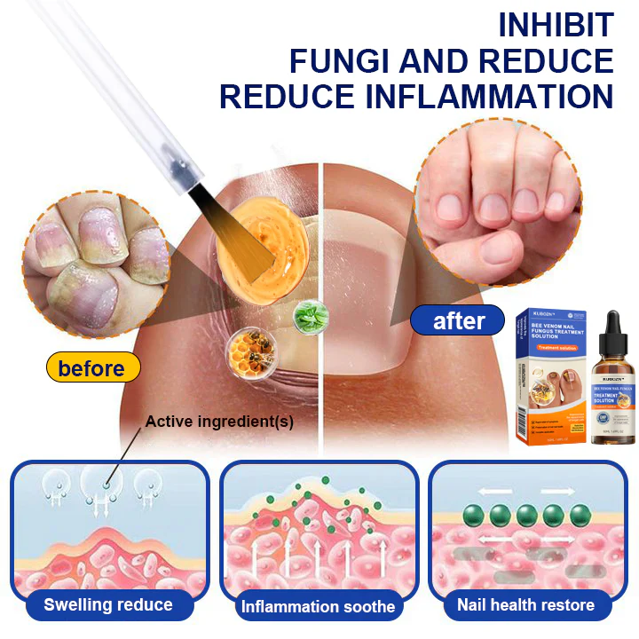 KUBOZN® Bee Venom Nail Fungus Treatment Solution👣👣