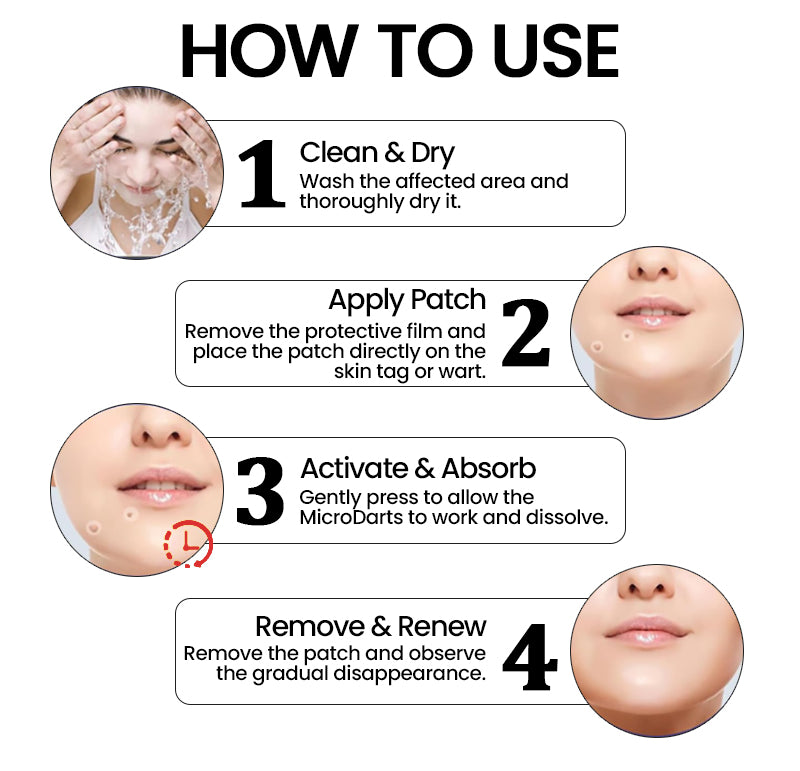 ✨ KUBOZN® Pro MicroDarts TAG'Gone Patch