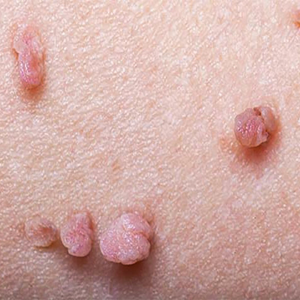 KUBOZN® Pro MicroDarts TAG'Gone Patch 16 KUBOZN® Pro MicroDarts TAG'Gone Patch