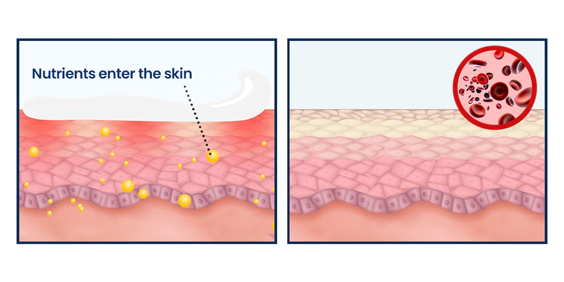 CVREOZ® SootheGlow Herbal Cream 26 CVREOZ® SootheGlow Herbal Cream