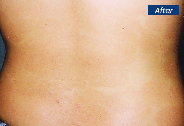 CVREOZ® SootheGlow Herbal Cream 22 CVREOZ® SootheGlow Herbal Cream