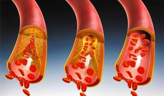 KUBOZN® Lymphatic Detox Herbal Cream 28 KUBOZN® Lymphatic Detox Herbal Cream