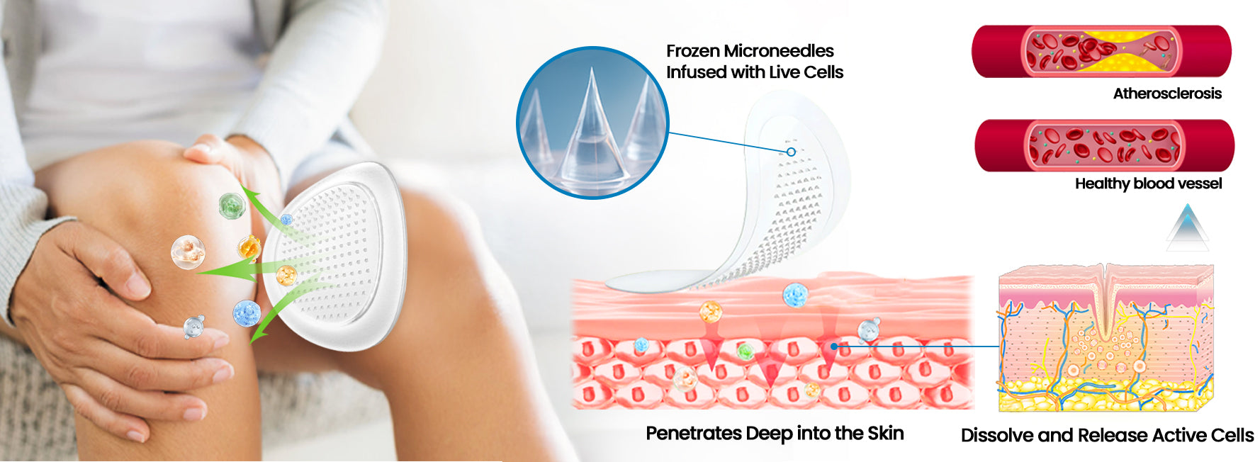 KUBOZN® Hyaluronic Joint Relief Microneedle Patch 19 Alt Image