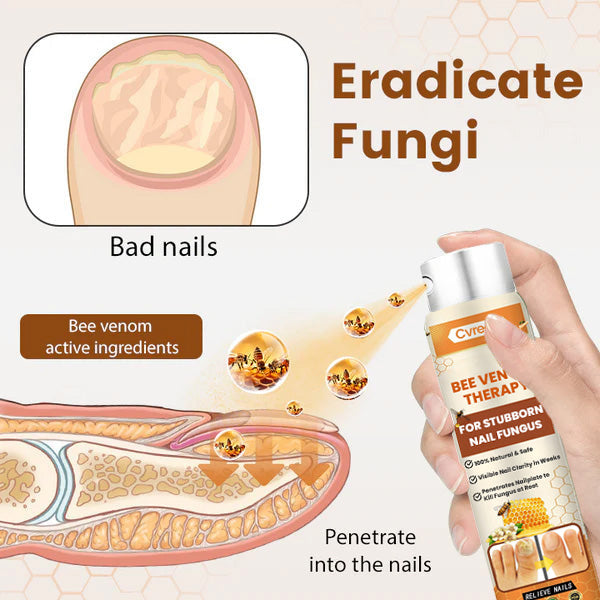 Cvreoz® Bee Venom Nail Fungus Spray (offer)