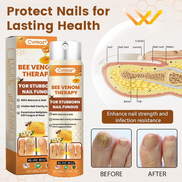 Cvreoz® Bee Venom Nail Fungus Spray (offer)