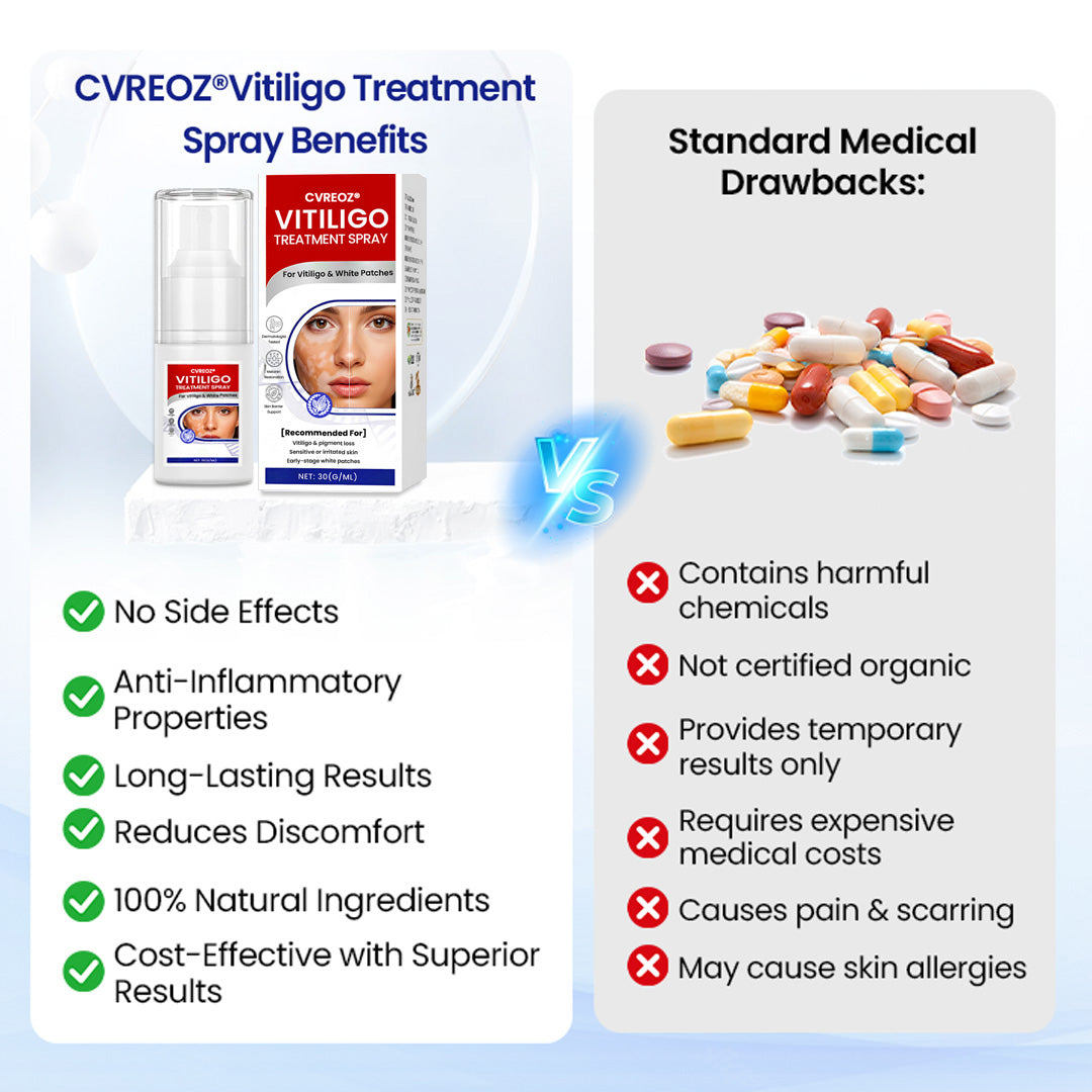 Cvreoz® Vitiligo Treatment Spray (offer)