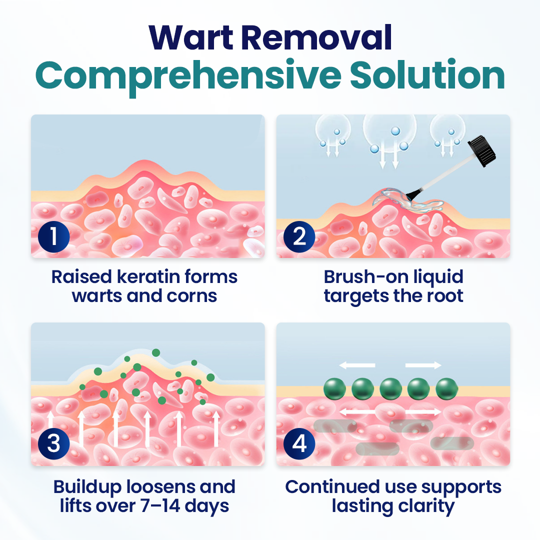 KUBOZN® WartLift Corn Removal Liquid