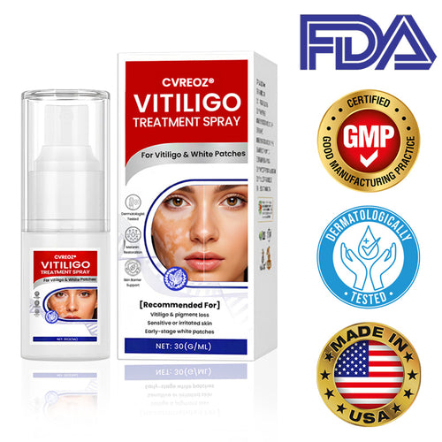 Cvreoz® Vitiligo Repigmentation Spray — Visible Results in 7 Days, Steroid-Free