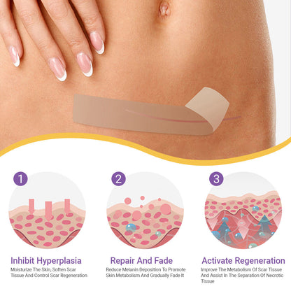 🪡 Cvreoz® Nano Microneedle Repair Tape — When Scar Creams Don’t Work 🅱︎ (offer)