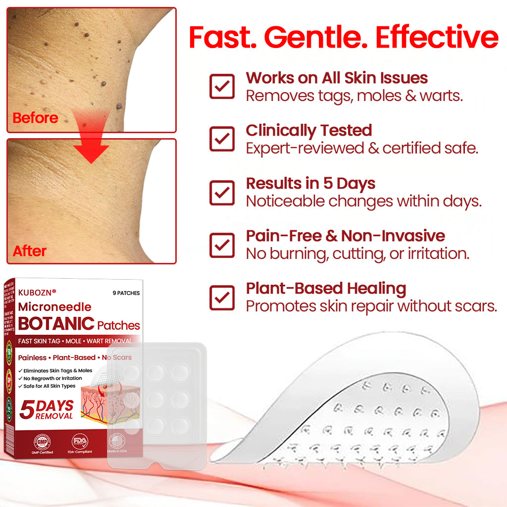 🔥KUBOZN® Microneedle Skin Tag Removal Patches – Visible Results in 5 Days 🅱︎