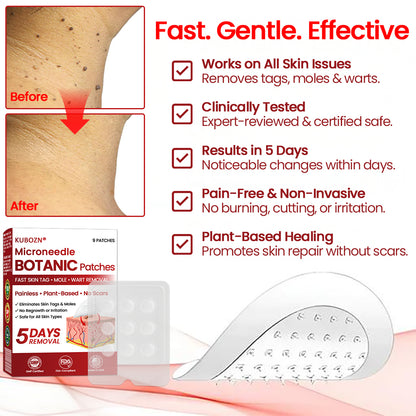 🔥KUBOZN® Microneedle Skin Tag Removal Patches – Visible Results in 5 Days 🅱︎