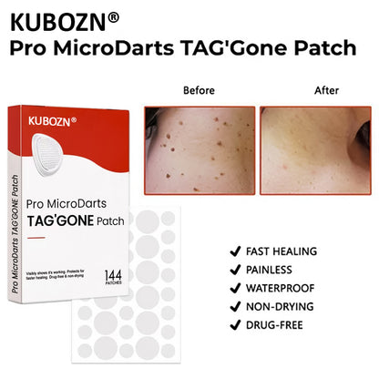 ✨ KUBOZN® Pro MicroDarts TAG'Gone Patch (Exclusive Offer)