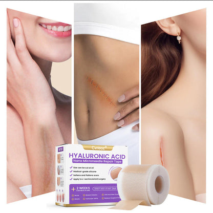🪡 Cvreoz® Nano Microneedle Repair Tape — When Scar Creams Don’t Work 🅱︎ (offer)