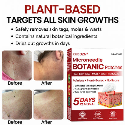 🔥KUBOZN® Microneedle Skin Tag Removal Patches – Visible Results in 5 Days 🅱︎