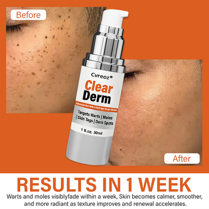 Cvreoz® ClearDerm Advanced Wart Mole & Dark Spot Repair Serum