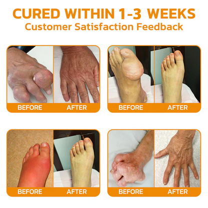 🇺🇸🏅  KUBOZN® MagniVen Magnesium & Bee Venom Joint Spray – 5 Min Relief · 7 Day Mobility · 4 Week Comfort