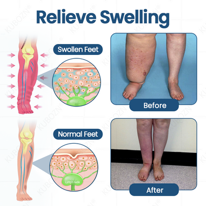 KUBOZN® Roll-On Pump Cream for Lymphatic Drainage & Swelling Relief