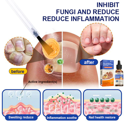 KUBOZN® Bee Venom Nail Fungus Treatment Solution👣👣