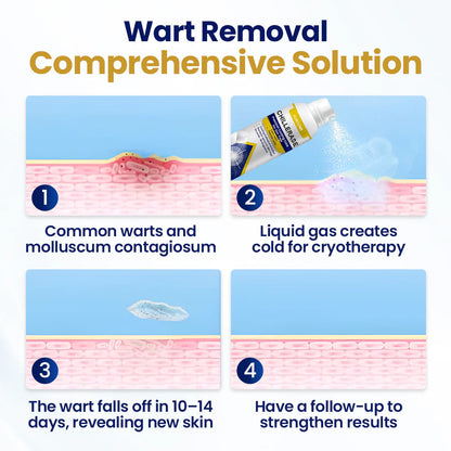 KUBOZN® ChillErase Cooling Spray for Skin Tags 🅱︎